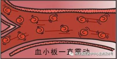 血小板是正常值的三倍？專家提醒小心血栓和出血！