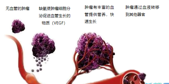 晚期腫瘤為什么會復(fù)發(fā)轉(zhuǎn)移？