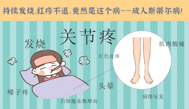 持續(xù)發(fā)燒、紅疹不退……她終于在這里治好了這個罕見病