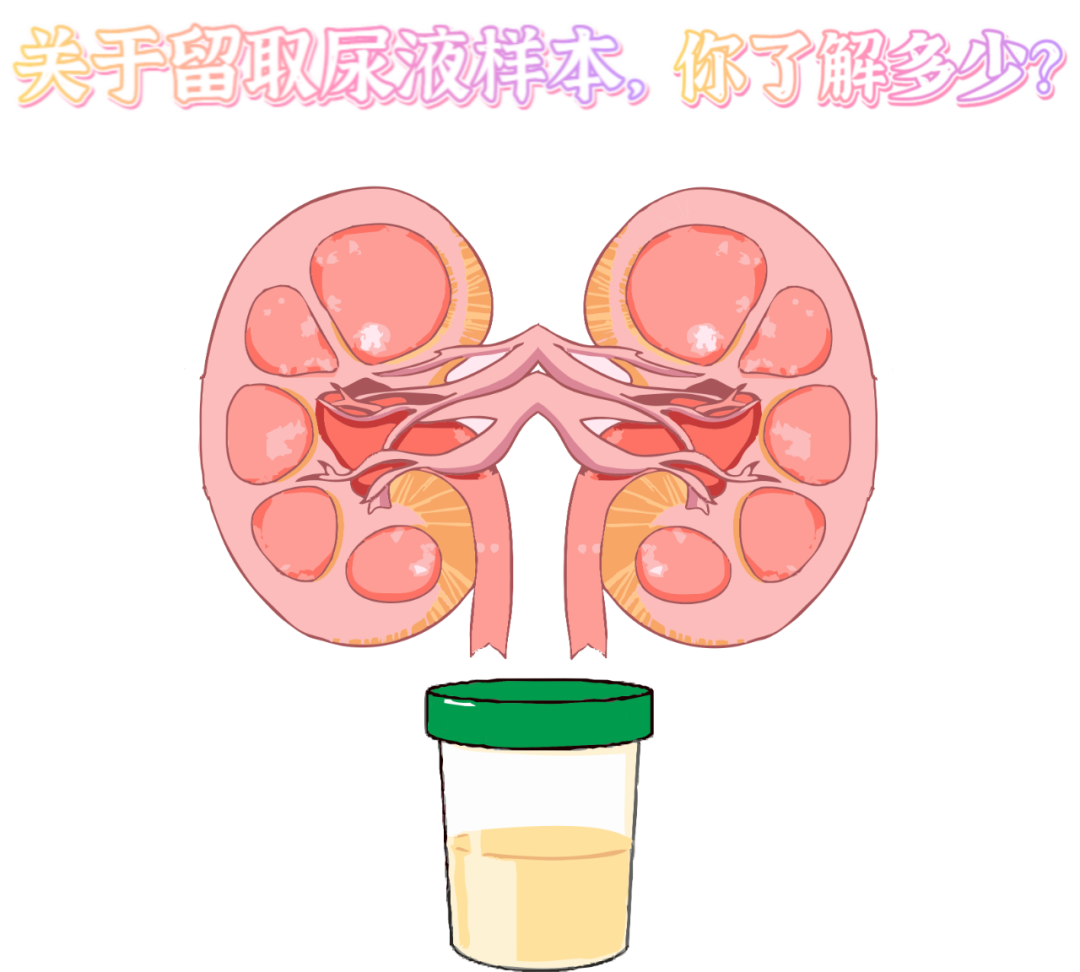 做尿檢，不得不說的注意事項！