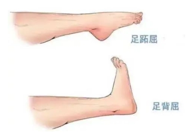 扭胯小連步、動(dòng)感搖花手……“科目三”雖火，運(yùn)動(dòng)損傷也要防！